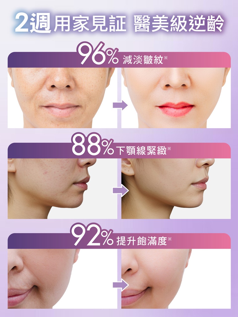 ZINO 雙A多肽抗老面霜