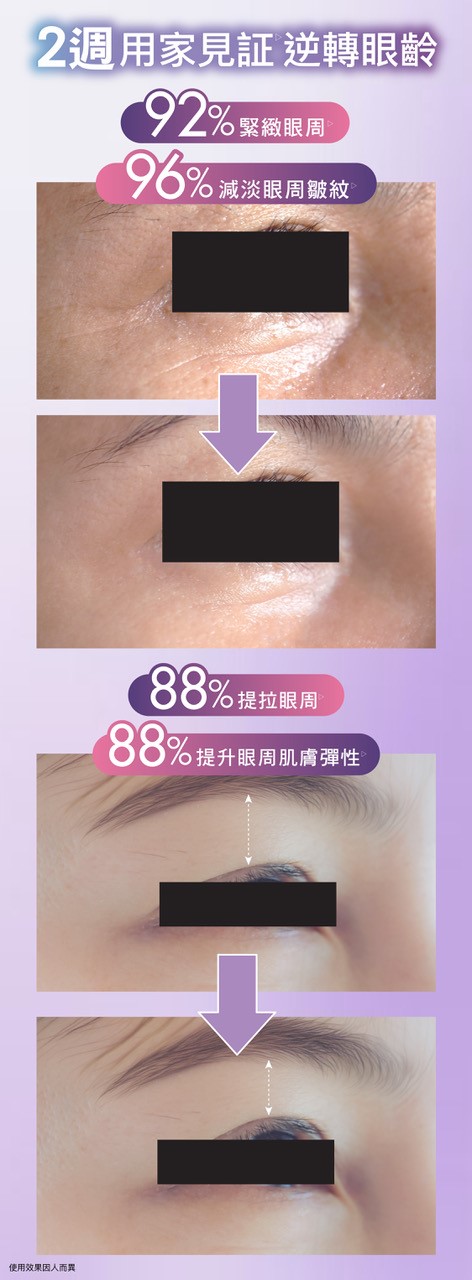 ZINO 雙A多肽緊緻眼霜